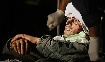 Un soldado ruso herido. (REUTERS)