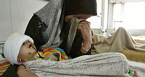 Un niño herido por una bomba de racimo en Irak en 2003. | A. Niedringhaus