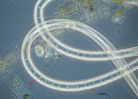 Bactería gigante de sulfato, en el Pacífico Sur. | Web del CVM
