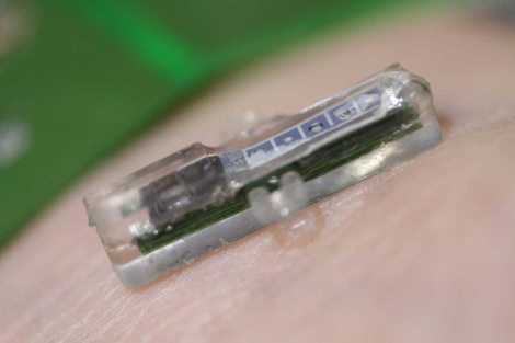 El implante mide dos centímetros. | EPFL