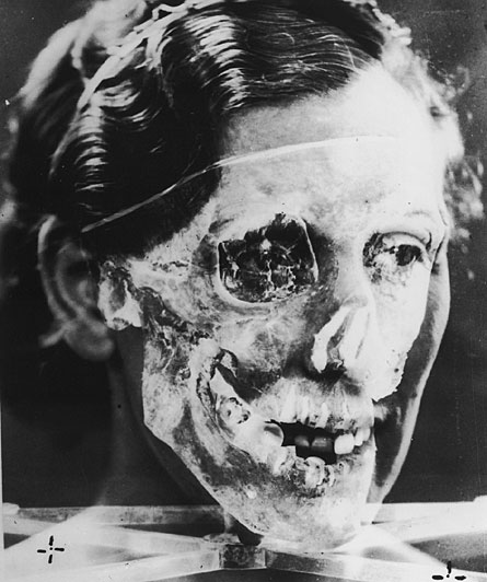 Compilado de noticias antiguas sobre medicina forense + yapa Compilado de noticias antiguas sobre medicina forense + yapa