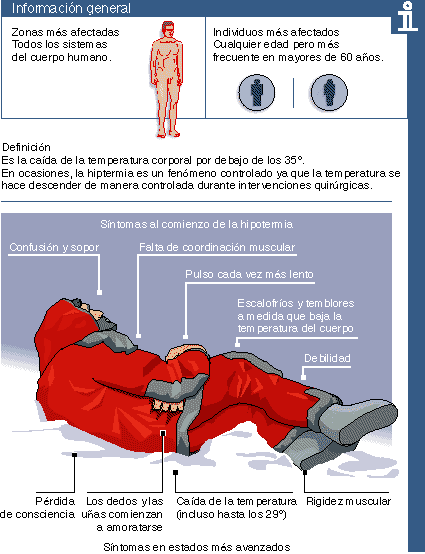 EL TRADUCTOR DE ELMUNDO ES el traductor de elmundo es: