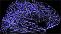 Imagen del cerebro