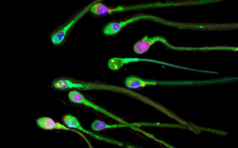 Espermatozoides humanos. | Science