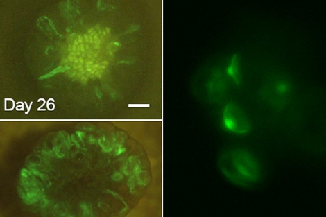 Los investigadores se ayudaron de una proteína fluorescente para ver sus avances.| Nature