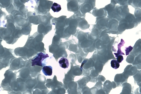 Muestra del 'Plasmodium falciparum' responsable de la malaria.| Maite Corcuera | H. Carlos III