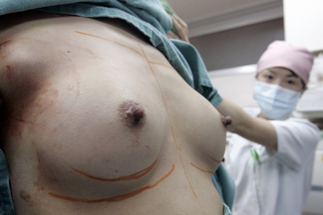 Una enfermera revisa los pechos recién operados de una paciente. | Reuters