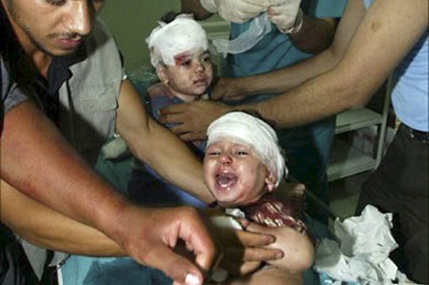 Dos niños saharauis atendidos con heridas en la cabeza. | Efe